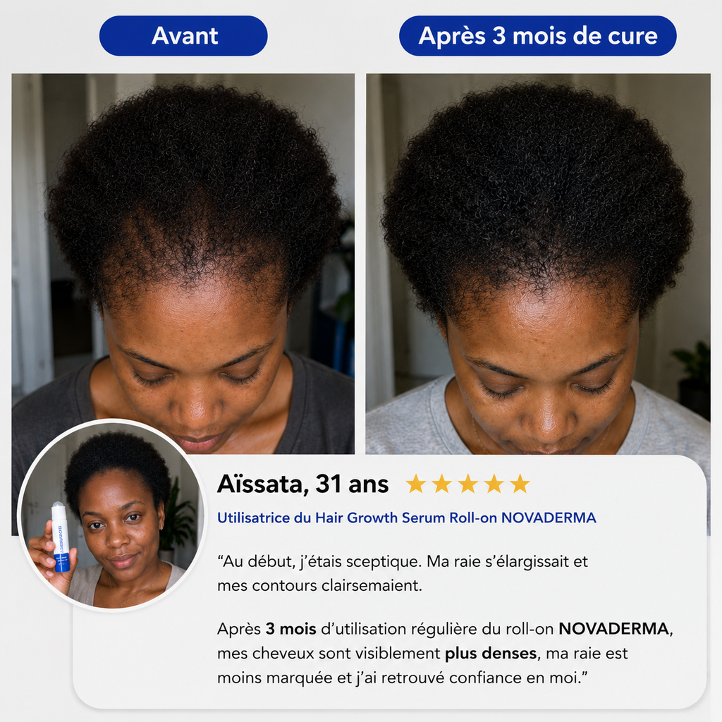 NovaDerma™ Sérum Roll-on Anti-Chute & Stop chute de cheveux