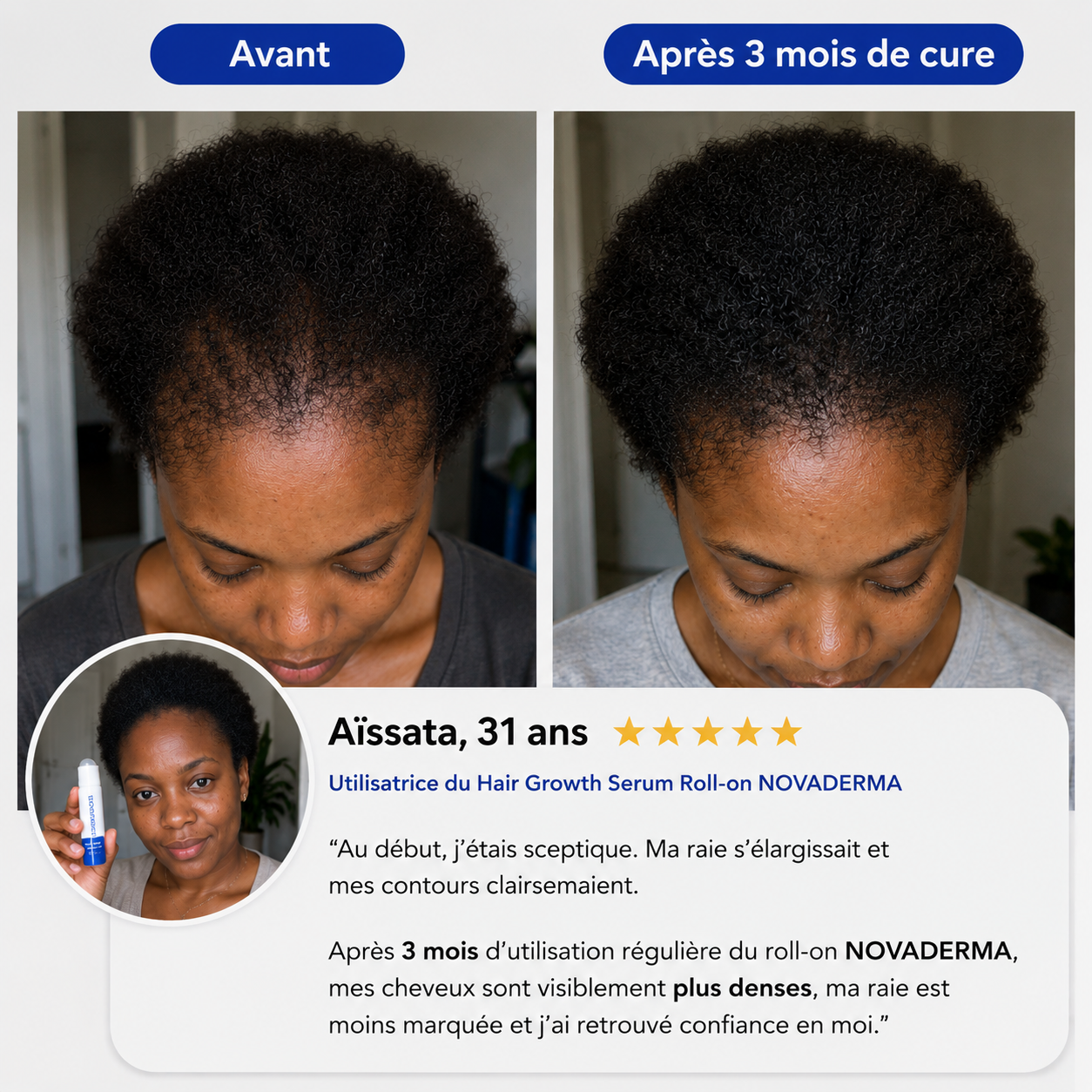 NovaDerma™ Sérum Roll-on Anti-Chute & Stop chute de cheveux