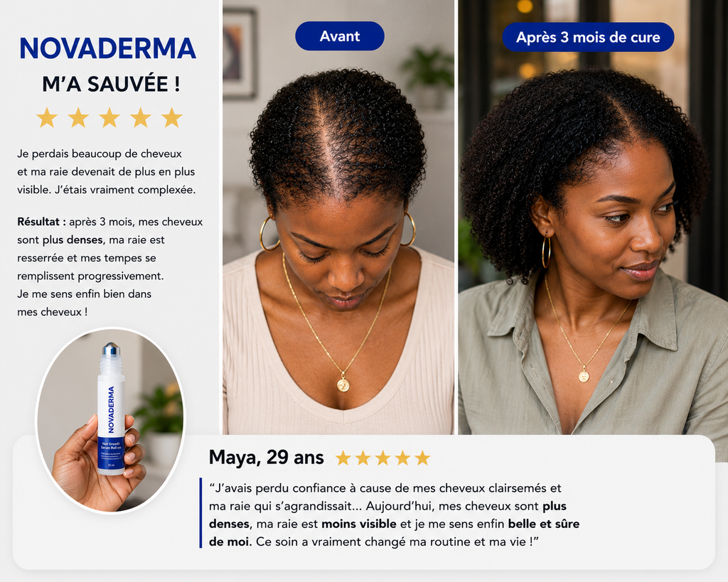 NovaDerma™ Sérum Roll-on Anti-Chute & Stop chute de cheveux