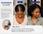 NovaDerma™ Sérum Roll-on Anti-Chute & Stop chute de cheveux