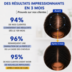 NovaDerma™ Sérum Roll-on Anti-Chute & Stop chute de cheveux
