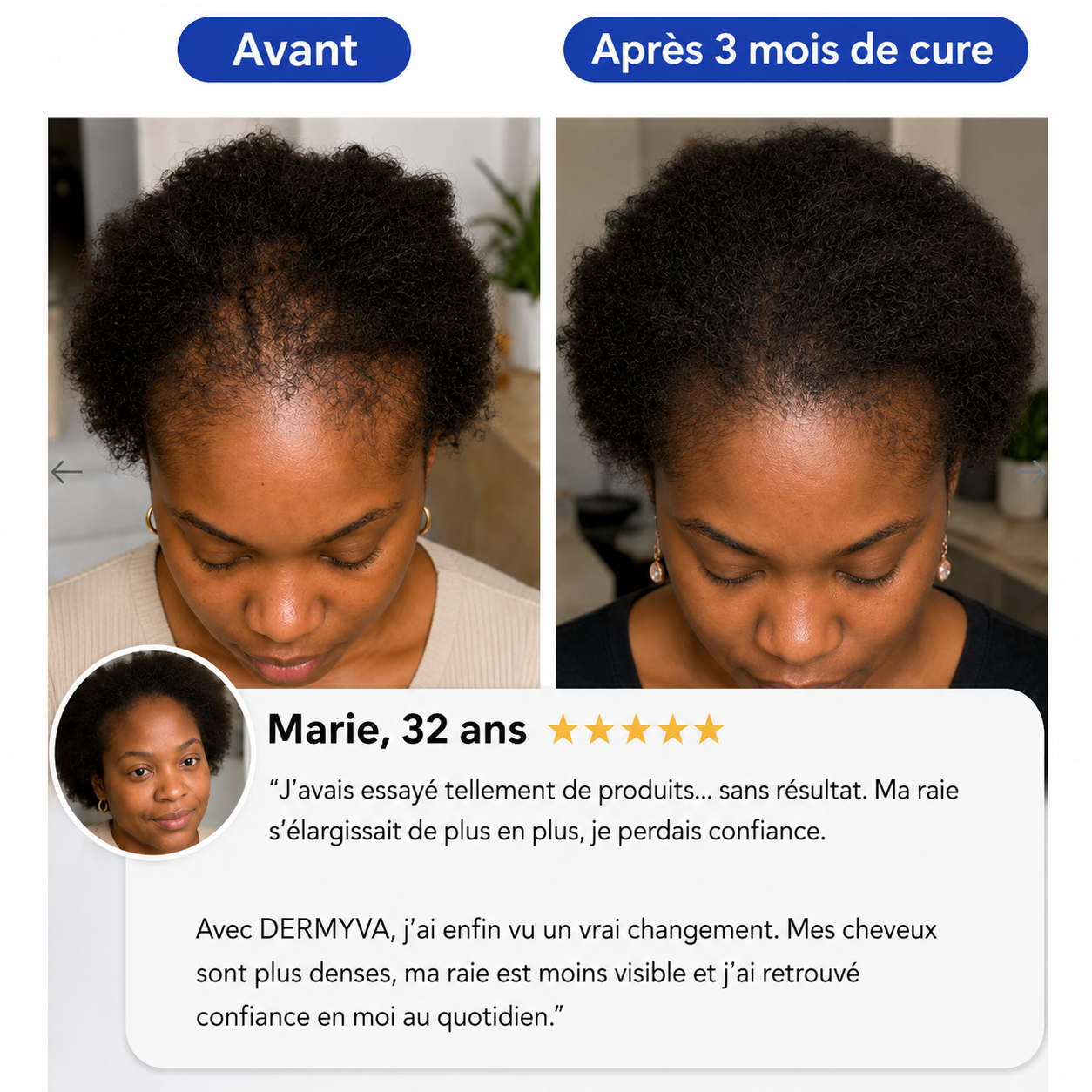 NovaDerma™ Sérum Roll-on Anti-Chute & Stop chute de cheveux
