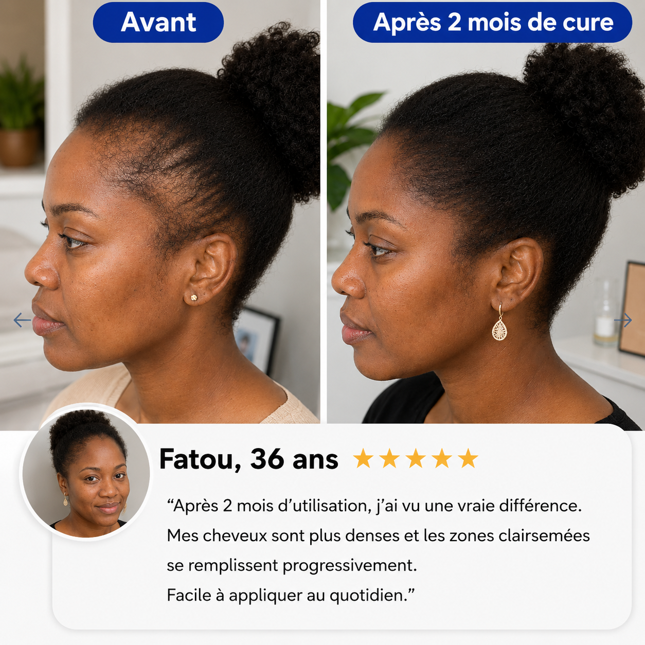 NovaDerma™ Sérum Roll-on Anti-Chute & Stop chute de cheveux