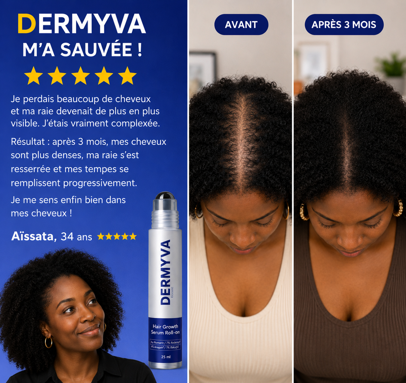 NovaDerma™ Sérum Roll-on Anti-Chute & Stop chute de cheveux