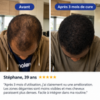 NOVADERMA™ Sérum Roll-on Anti-Chute & Stop Calvitie