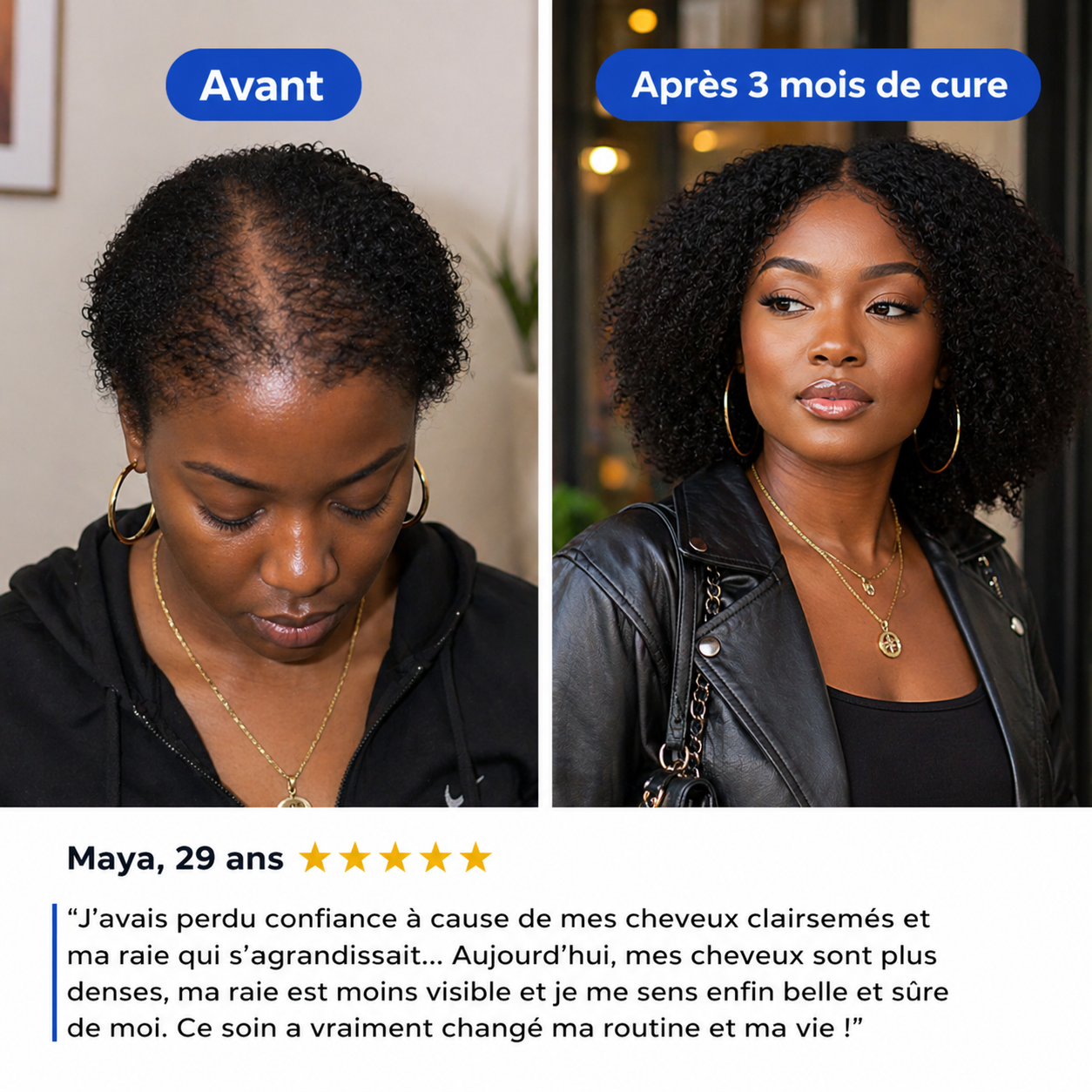 NovaDerma™ Sérum Roll-on Anti-Chute & Stop chute de cheveux