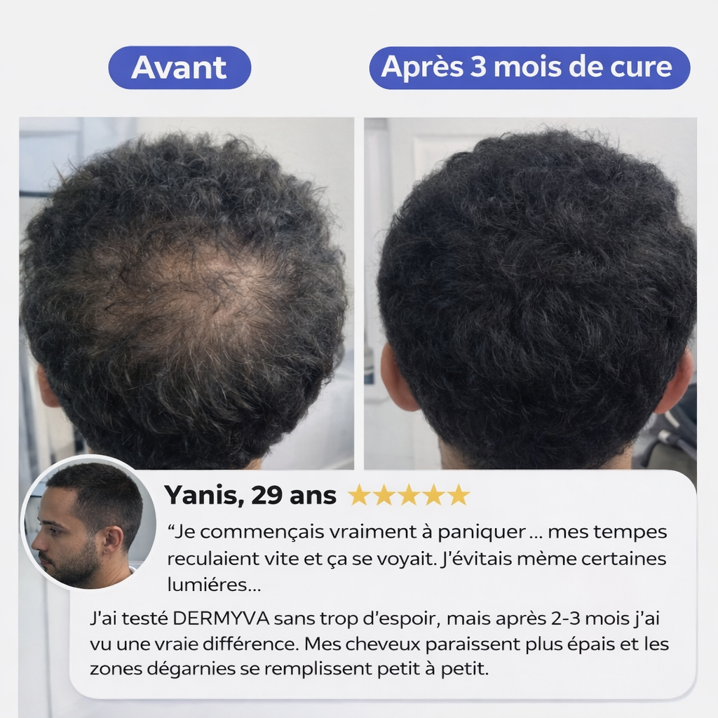 NOVADERMA™ Sérum Roll-on Anti-Chute & Stop Calvitie
